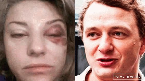 Жената на Марат Башарова му прости напад